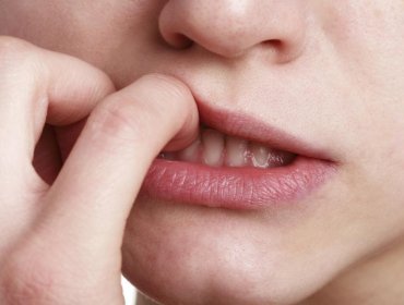 I migliori rimedi per smettere di mangiarsi le unghie