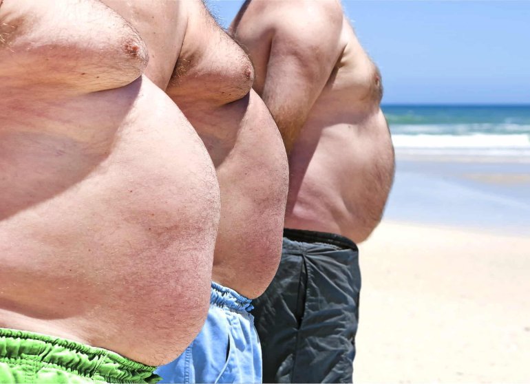 Sovrappeso e obesità: tutti i rischi per la salute 